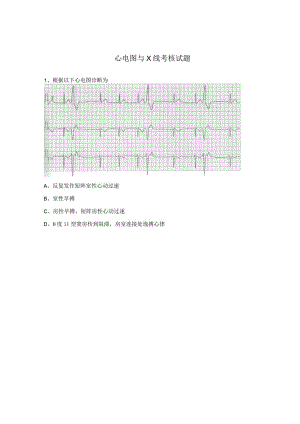 心电图与X线考核试题 .docx