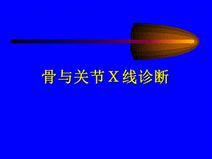 骨与关节X线诊断2.ppt