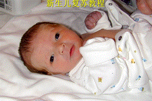 新生儿复苏教程.ppt