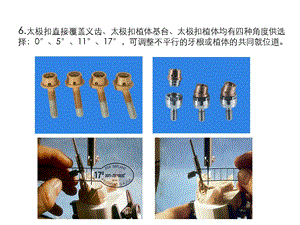 太极扣附着体修复技术2.ppt