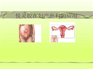 “悦灵胶”妇产科应用.ppt