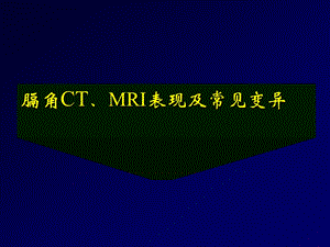膈角CTMRI表现及常见变异王俭.ppt