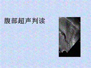 腹部超声判读.ppt