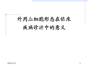 外周血细胞形态异常与临床的联系.ppt