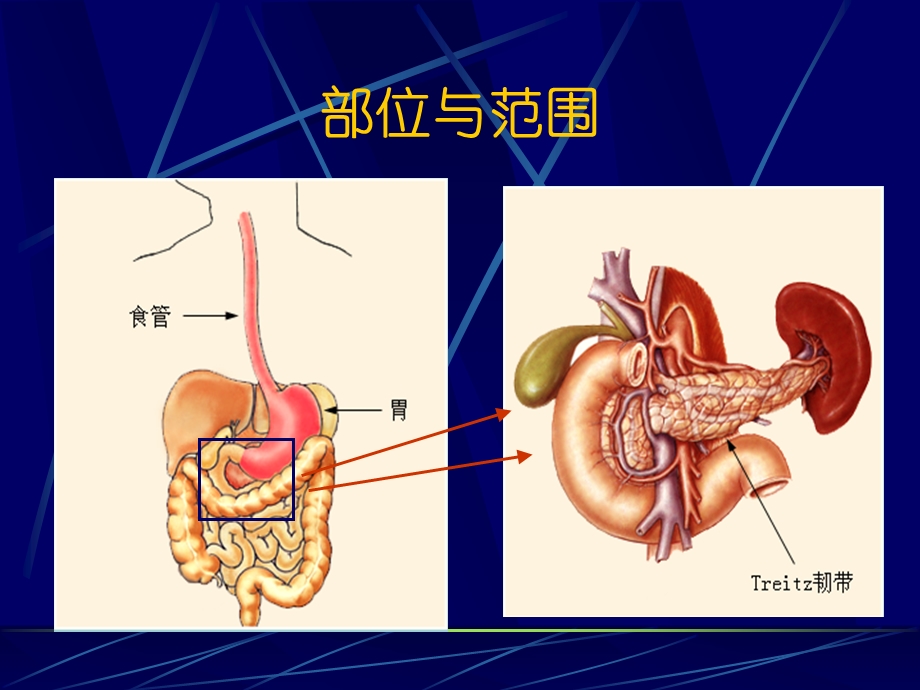 消化道出血急诊学.ppt_第3页