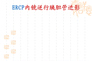 ERCP业务学习.ppt