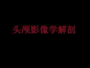 [临床医学]头颅影像学解剖ppt.ppt