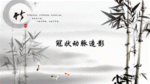 冠状动脉造影.ppt