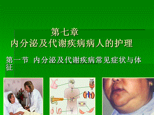 内分泌及代谢疾病常见症状与体征PPT演示文稿.ppt