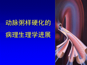 动脉粥样硬化基础培训.ppt