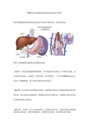2024食管胃底静脉曲张破裂出血要点（附图）.docx