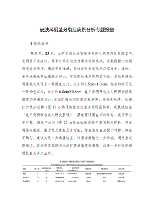 皮肤科阴茎分裂痣病例分析专题报告.docx