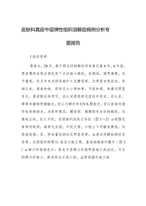 皮肤科真皮中层弹性组织溶解症病例分析专题报告.docx