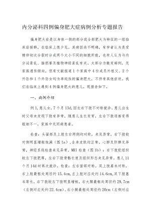 内分泌科四例偏身肥大症病例分析专题报告.docx