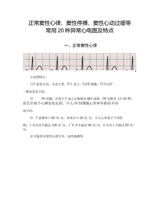 正常窦性心律、窦性停搏、窦性心动过缓等常用20种异常心电图及特点.docx