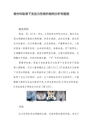 骨外科耻骨下支应力性骨折病例分析专题报告.docx