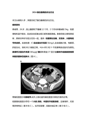 2024肠白塞病的诊治方法.docx