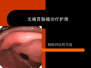 无痛消化内镜护理.ppt