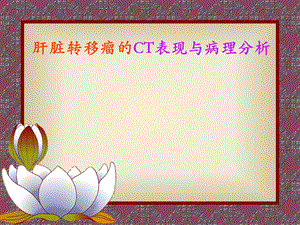 肝脏转移瘤的CT表现与病理幻灯.ppt
