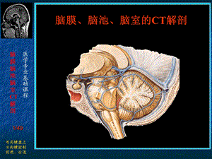 脑膜、脑池、脑室的CT解剖.ppt
