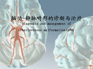 脑动静脉畸形的诊治.ppt
