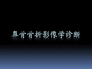 鼻骨骨折影像学诊断与鉴别.ppt
