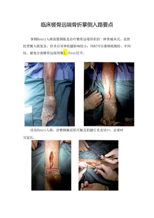 临床桡骨远端骨折掌侧入路要点.docx