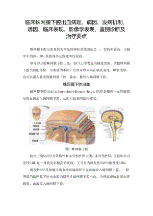 临床蛛网膜下腔出血病理、病因、发病机制、诱因、临床表现、影像学表现、鉴别诊断及治疗要点.docx