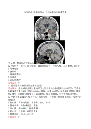 内分泌学(医学高级)：下丘脑垂体疾病找答案.docx