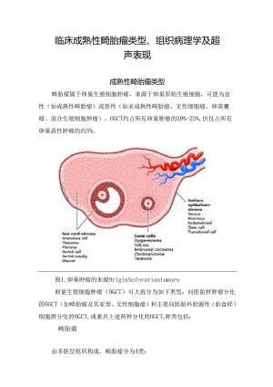 临床成熟性畸胎瘤类型、组织病理学及超声表现.docx