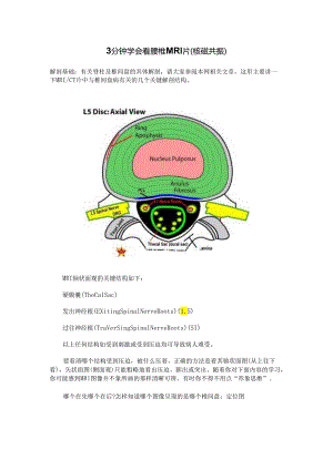 3分钟学会看腰椎MRI片.docx