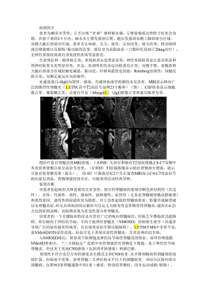 CNS神经结节病（脊髓神经结节病）治疗 病例探究.docx