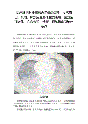 临床肺脂肪栓塞综合征疾病病理、发病原因、机制、肺部病理变化主要表现、脑部病理变化、临床表现、诊断、预防措施及治疗要点.docx